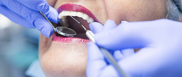 Best Dentist for Tooth Abscess  in Lakeland, MN